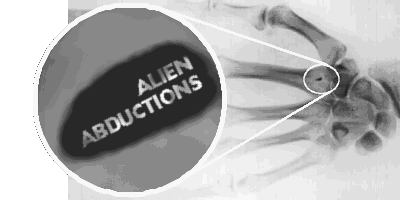 Alien Abductions